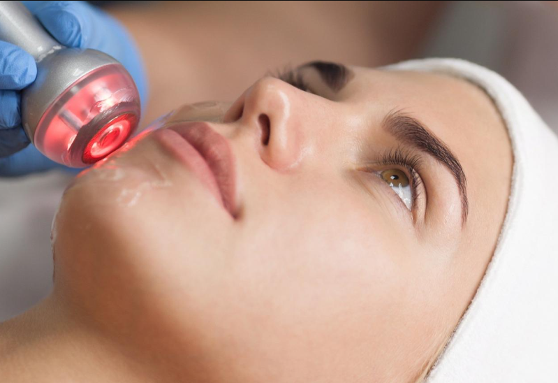 séances de radiofréquence